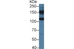Western blot analysis of Mouse Liver lysate, using Human GLDC Antibody (2 µg/ml) and HRP-conjugated Goat Anti-Rabbit antibody (