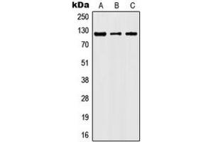 Western blot analysis of JAK2 (pY1007) expression in HeLa (A), TF1 (B), NIH3T3 (C), rat kidney (D) whole cell lysates.