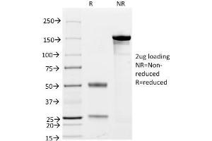 SDS-PAGE Analysis Purified CD79a Mouse Monoclonal Antibody (JCB117 + HM47/A9).