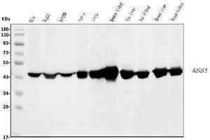 Western blot analysis of ASS1 using anti-ASS1 antibody (ABIN7601192).