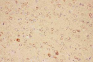 Anti-CNTF Picoband antibody, IHC(P): Rat Brain Tissue