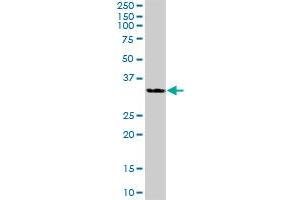 HSD11B1 MaxPab polyclonal antibody. (HSD11B1 antibody  (AA 1-292))