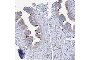Immunohistochemical staining of human fallopian tube with DNAH6 polyclonal antibody  shows strong membranous positivity in glandular cells. (DNAH6 antibody)