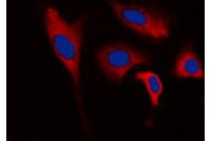 Immunofluorescent analysis of INPP5J staining in HEK293T cells. (INPP5J antibody  (C-Term))