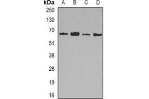 Western blot analysis of Lamin B2 expression in HepG2 (A), MCF7 (B), mouse liver (C), mouse heart (D) whole cell lysates. (Lamin B2 antibody)