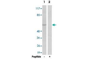 Western blot analysis of extracts from HeLa cells, using ADRB2 polyclonal antibody . (beta 2 Adrenergic Receptor antibody  (C-Term))