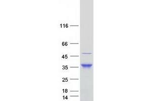 Validation with Western Blot