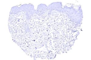 Absence of KRT13 staining in the keratinizing squamous epithelium of the skin (Cytokeratin 13 antibody)
