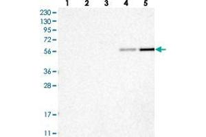Western blot analysis of Lane 1: RT-4, Lane 2: U-251 MG, Lane 3: Human Plasma, Lane 4: Liver, Lane 5: Tonsil with RMND1 polyclonal antibody .