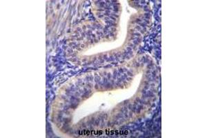 TBPL2 Antibody (N-term) immunohistochemistry analysis in formalin fixed and paraffin embedded human uterus tissue followed by peroxidase conjugation of the secondary antibody and DAB staining. (Tbpl2 antibody  (N-Term))