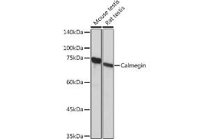 Western blot analysis of extracts of various cell lines, using Calmegin Rabbit mAb (ABIN7266026) at 1:1000 dilution. (Calmegin antibody)