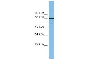 WB Suggested Anti-RAD18 Antibody Titration: 0.