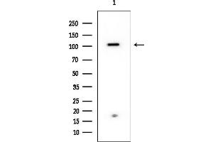 Western blot analysis of lysates from HUVEC cells, using EPS15 Mouse Monoclonal Antibody at 1/1000 dilution.