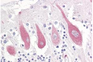 Anti-ITPR1 antibody IHC staining of human brain, cerebellum. (ITPR1 antibody  (AA 1566-1615))