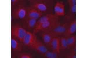 IF analysis of Seryl-TRNA Synthetase/SERS/SARS1 using anti-Seryl-TRNA Synthetase/SERS/SARS1 antibody (ABIN7602365).
