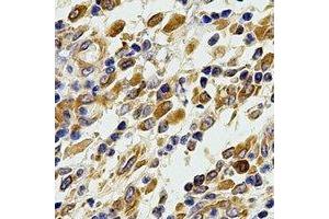Immunohistochemical analysis of Glutaredoxin staining in human stomach formalin fixed paraffin embedded tissue section. (Glutaredoxin 1 antibody)