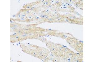 Immunohistochemistry of paraffin-embedded Mouse heart using NAT8B Polyclonal Antibody at dilution of 1:200 (40x lens). (NAT8B antibody)