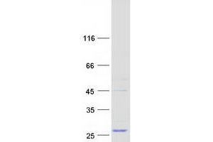 Validation with Western Blot (RABL4 Protein (Myc-DYKDDDDK Tag))
