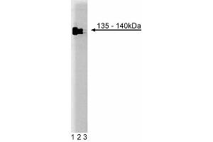 Western blot analysis of TFII-I on HeLa cell lysate. (GTF2I antibody  (AA 17-123))