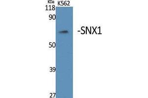 Western Blotting (WB) image for anti-Sorting Nexin 1 (SNX1) (Internal Region) antibody (ABIN3187014) (Sorting Nexin 1 antibody  (Internal Region))