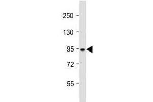 Western blot testing of Dnmt3b antibody at 1:2000 dilution + T47D lysate; Predicted molecular weight: 95 kDa. (DNMT3B antibody  (AA 389-417))
