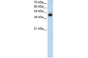 WB Suggested Anti-MTUS1 Antibody Titration: 1. (MTUS1 antibody  (N-Term))