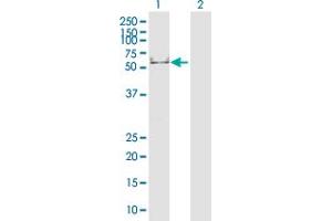 Western Blot analysis of KRT16 expression in transfected 293T cell line by KRT16 MaxPab polyclonal antibody. (KRT16 antibody  (AA 1-473))
