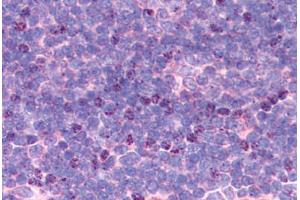 Thymus (KDM4C antibody  (AA 475-525))