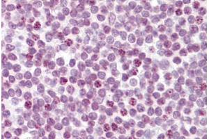 Anti-RB2 antibody IHC staining of human tonsil. (p130 antibody  (AA 175-189))
