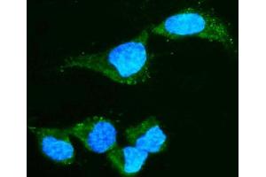 IF analysis of Alpha A Crystallin using anti-Alpha A Crystallin antibody (ABIN7599030). (CRYAA antibody  (AA 1-173))
