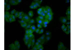 Immunofluorescence staining of HepG2 cells with ABIN7152402 at 1:166, counter-stained with DAPI. (Cyclin F antibody  (AA 248-400))