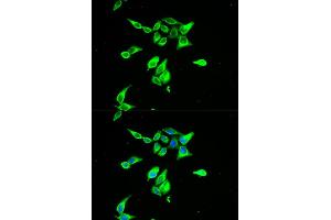 Immunofluorescence analysis of A549 cells using CD55 antibody (ABIN5970570).