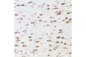 Immunohistochemistry of paraffin-embedded rat brain using ARHGAP5 antibody. (ARHGAP5 antibody  (AA 1292-1501))