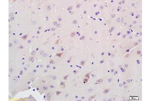 Formalin-fixed and paraffin embedded rat brain labeled with Anti-ADAMTS7 Polyclonal Antibody, Unconjugated (ABIN672486) at 1:200 followed by conjugation to the secondary antibody and DAB staining. (ADAMTS7 antibody  (AA 241-340))