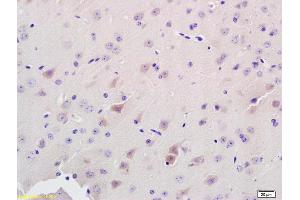 Formalin-fixed and paraffin embedded rat brain labeled with Anti-ADAMTS7 Polyclonal Antibody, Unconjugated (ABIN672486) at 1:200 followed by conjugation to the secondary antibody and DAB staining.