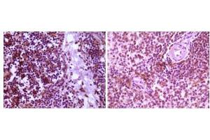 Immunohistochemical analysis of paraffin-embedded human thymoma tissue (left) and spleen tissue (right), showing cytoplasmic localization using MAP2K4 mouse mAb with DAB staining. (MAP2K4 antibody)