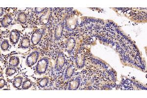 Immunohistochemistry (IHC) image for anti-Interferon alpha/beta Receptor 2 (IFNAR2) (AA 27-243) antibody (ABIN7435736)