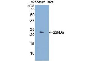 Western Blotting (WB) image for anti-C-Type Lectin Domain Family 4, Member M (CLEC4M) (AA 242-399) antibody (ABIN1858422) (C-Type Lectin Domain Family 4, Member M (CLEC4M) (AA 242-399) antibody)