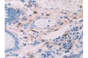Immunohistochemistry (IHC) image for anti-Alcohol Dehydrogenase 1 (Class I) (ADH1) (AA 169-370) antibody (ABIN7432379)