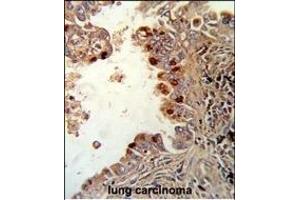 Immunohistochemistry (Paraffin-embedded Sections) (IHC (p)) image for anti-Protein Kinase C, alpha (PKCa) (AA 75-103), (N-Term) antibody (ABIN652517)