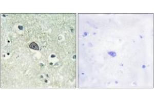 Immunohistochemistry analysis of paraffin-embedded human brain, using NMDAR1 (Phospho-Ser890) Antibody. (GRIN1/NMDAR1 antibody  (pSer890))