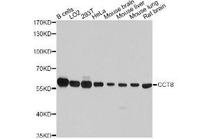 Western blot analysis of extracts of various cell lines, using CCT8 antibody. (CCT8 antibody  (AA 248-497))