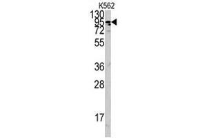 Western blot analysis of ACE2 polyclonal antibody  in K-562 cell lysate (35 ug/lane).