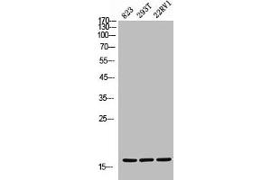 Western Blot analysis of 823 293T 22RV cells using CD235a Polyclonal Antibody (CD235a/GYPA antibody  (Internal Region))