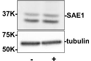 Western blot using  Rabbit anti-SAE1 antibody shows detection of SAE1.