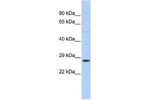 RAB38 antibody used at 1 ug/ml to detect target protein.