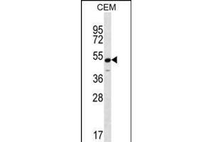 KCNJ8 Antibody (N-term) (ABIN656236 and ABIN2845552) western blot analysis in CEM cell line lysates (35 μg/lane). (KCNJ8 antibody  (N-Term))