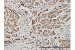 Immunostaining (ISt) image for anti-EPH Receptor B6 (EPHB6) (AA 23-122) antibody (ABIN560773)