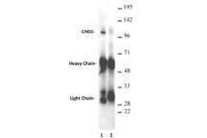 CHD3 antibody (rAb) tested antibody tested by immunoprecipitation. (Recombinant CHD3 antibody  (AA 865-885))