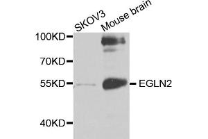 Western blot analysis of extracts of various cell lines, using EGLN2 antibody (ABIN5971259) at 1/1000 dilution. (PHD1 antibody)